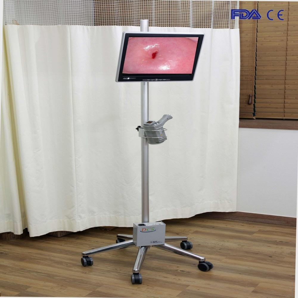 TeleCervico System