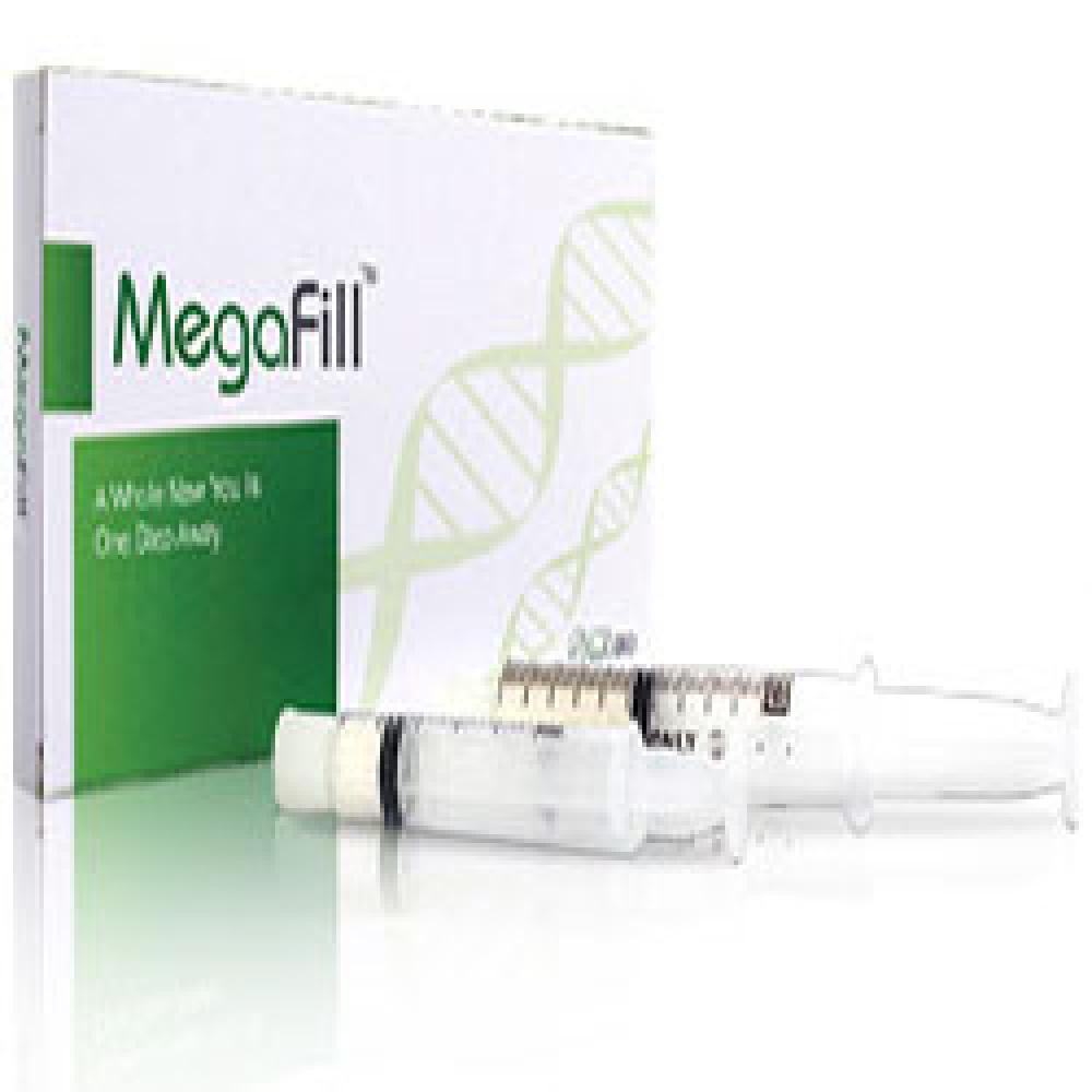 MegaFill