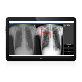 detail image1 DxRAD(Digital X-ray Radiography Auto Decipher based on AI)