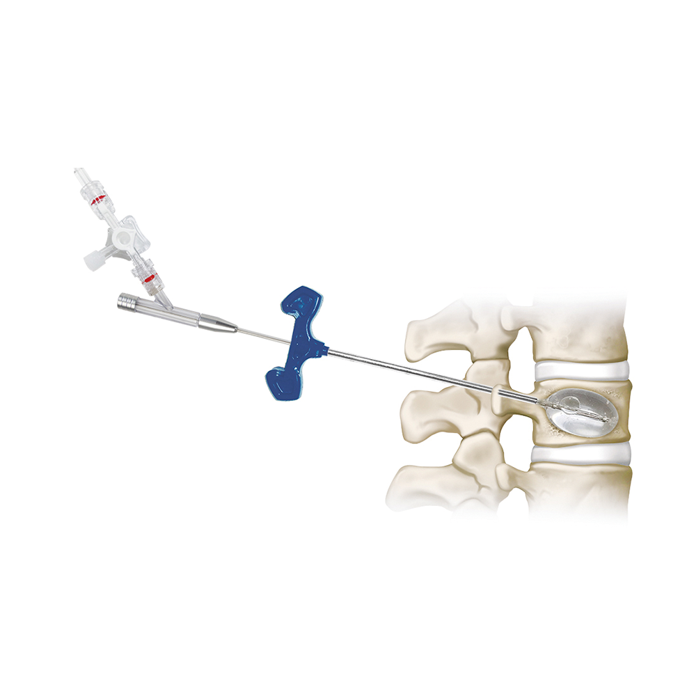 Kyphoplasty Balloon system