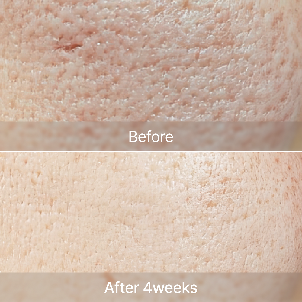 ZINC-HAZEL Pore Minimizing Infusion 30ml
